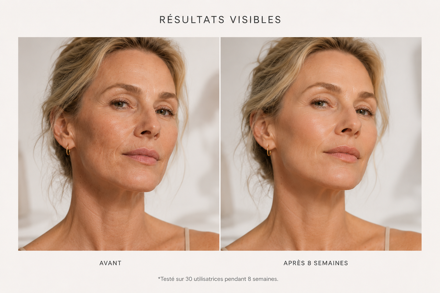 LYREM™ Facial Sculptor – Technologie EMS & LED 7 couleurs